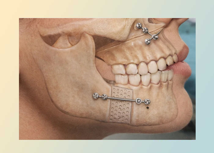 نقش جراحی فک در بهبود جویدن، تنفس و گفتار