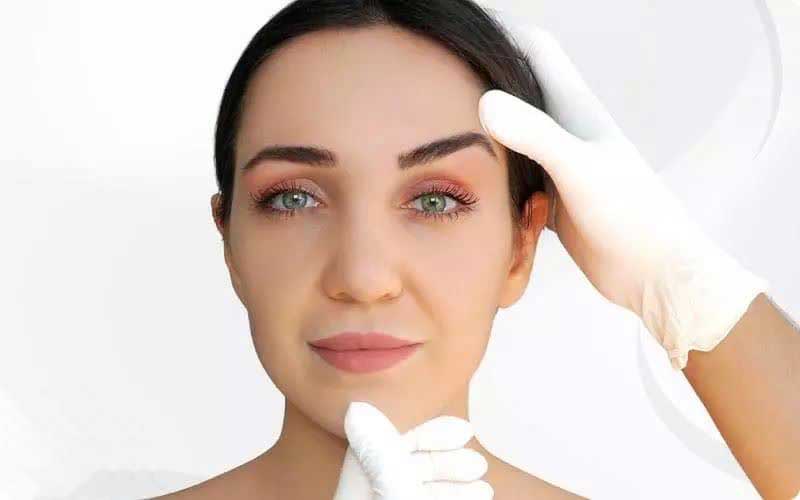 لیفت شقیقه چیست و بهترین روش لیفت شقیقه کدام است