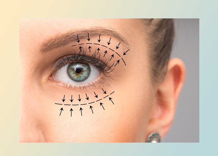 بلفاروپلاستی چیست و چه زمانی جنبه درمانی دارد؟